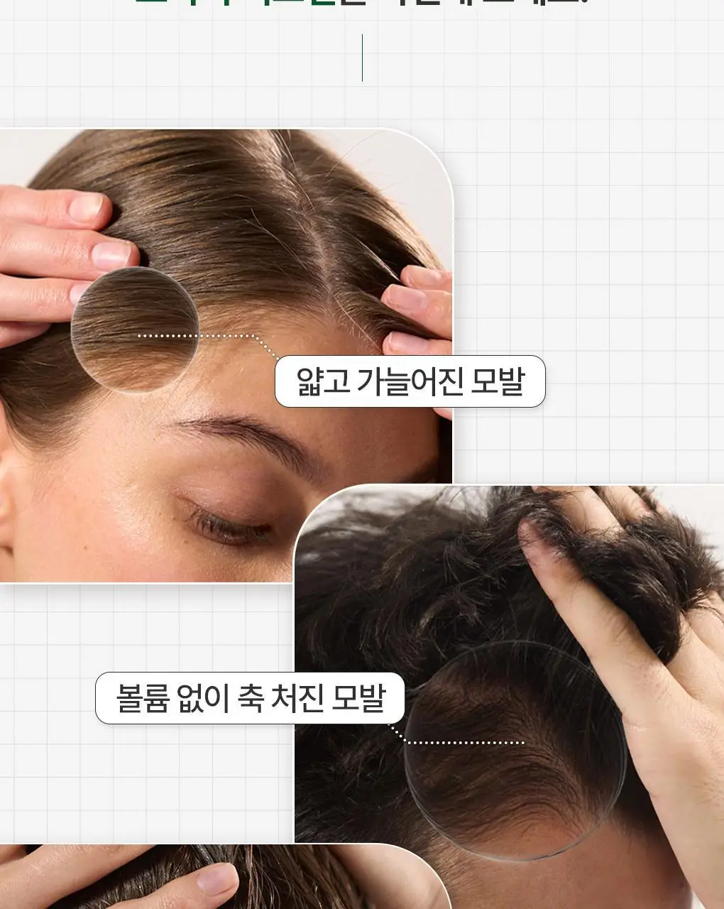 [두피 안티에이징 앰플] 클로란 퀴닌 두피 세럼 100ml 2입 기획 (NEW) 상세페이지 6
